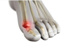 Where To Locate Expert Advice On Metatarsophalangeal Joint Pain In Scottsdale, AZ