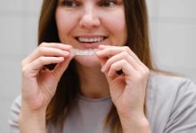 Achieving a Perfect Smile with Invisalign
