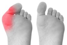 Say Goodbye to Bunion Pain with Minimally Invasive Surgery