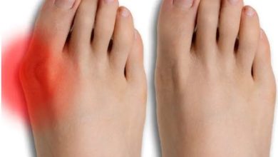 Where to Find Expert Minimally Invasive Bunion Surgery