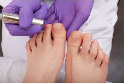 Where to Get Laser Toenail Treatment in Scottsdale
