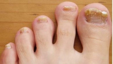 Where to Seek Help for Toenail Injuries Scottsdale's Top Center