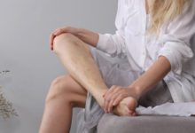 How Do I Choose a Qualified Provider for Spider Vein Treatment