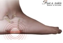 Which Conditions Cause Pain on Side of Foot