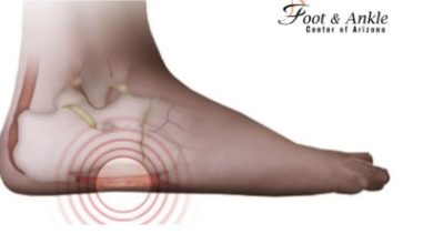 Which Conditions Cause Pain on Side of Foot