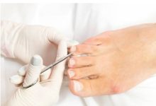 Why Choose Dr. DiNucci, Podiatrist in Scottsdale