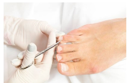 Why Choose Dr. DiNucci, Podiatrist in Scottsdale